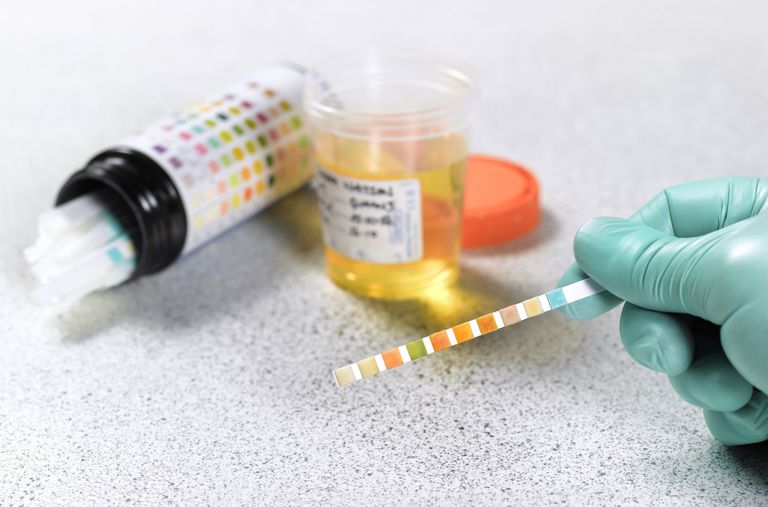 urine drug test kits (2).jpg